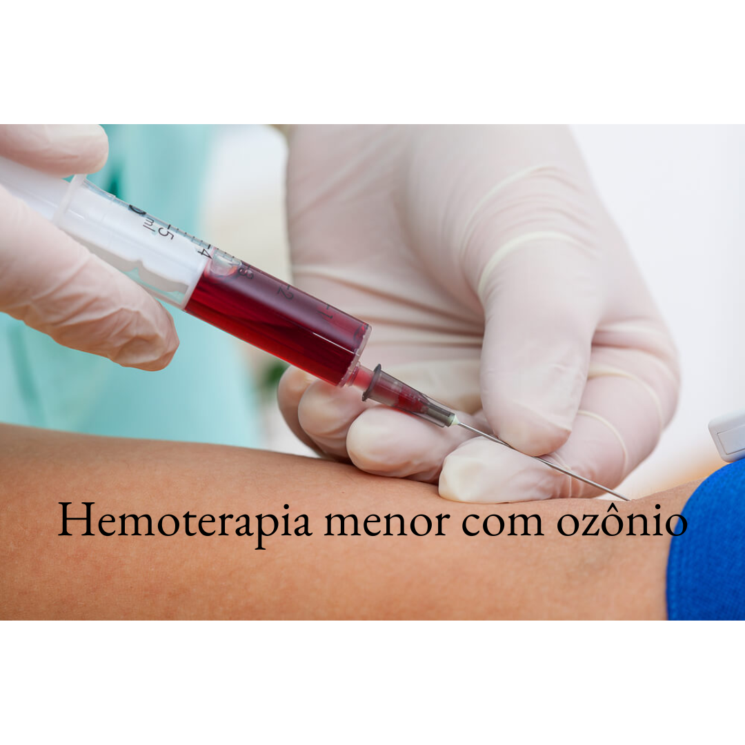 Outros Serviços
